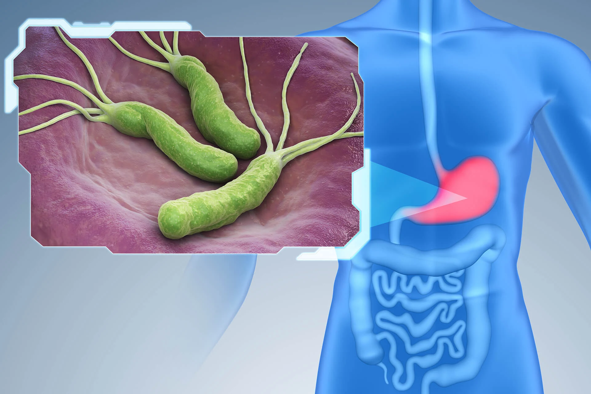 BREATH TEST PER LA DIAGNOSI DELL'HELICOBACTER PYLORI