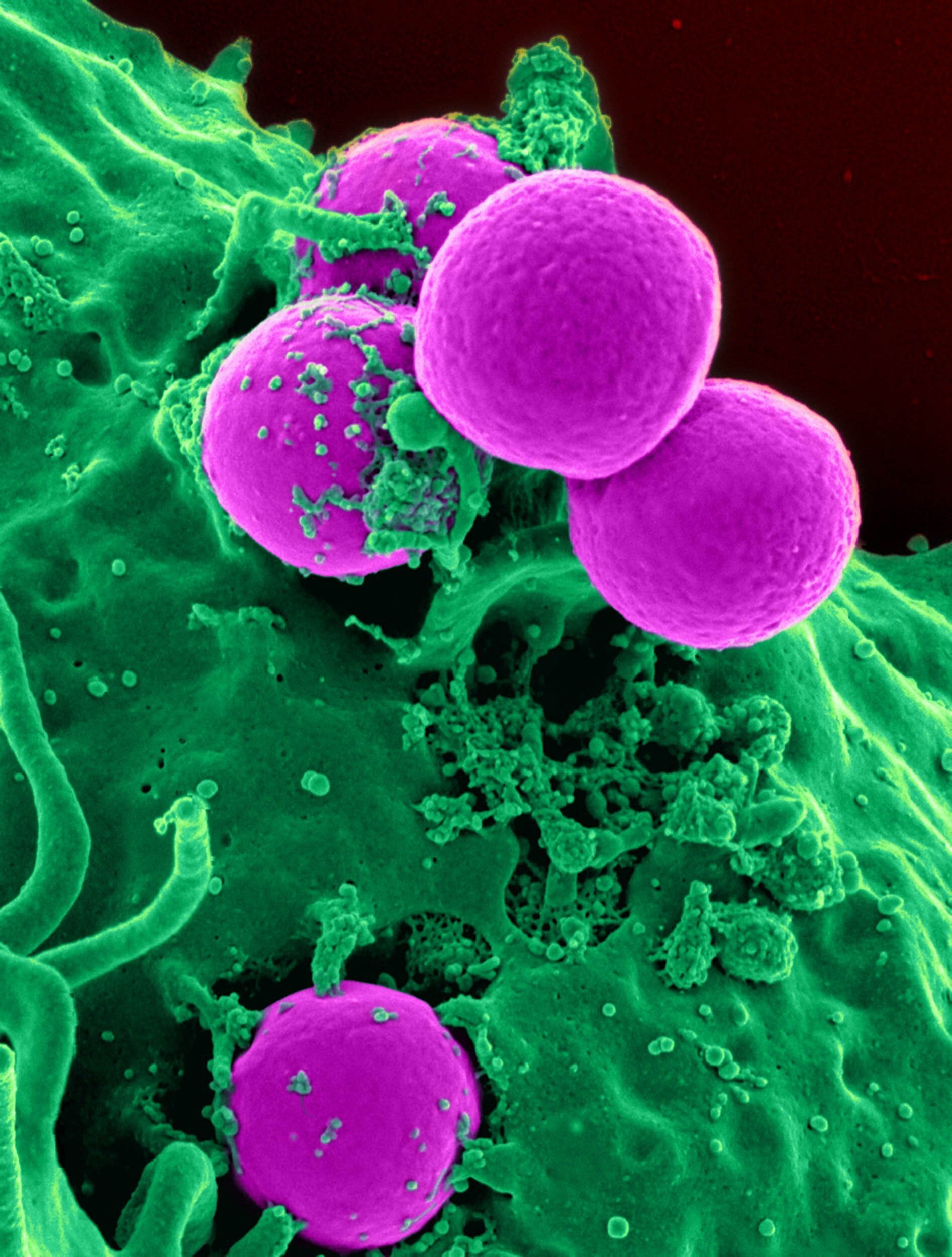 AKKERMANSIA MUCINIPHILA: UNO DEI BATTERI ARCHITRAVE DEL MICROBIOTA INTESTINALE