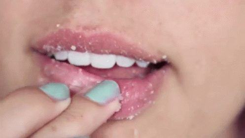 IL ROSSETTO ROSSO 