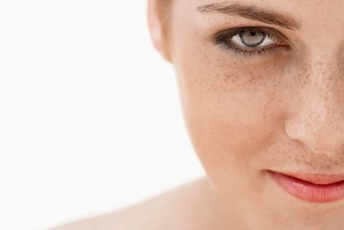 Macchie solari: prevenire è meglio che curare!